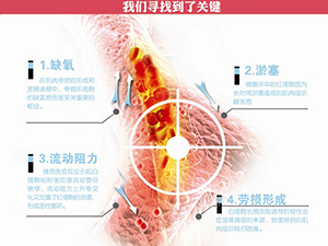 只需一分钟，肩颈很轻松！——恒怡运动是有效的