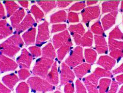 Mdx鼠的骨骼肌细胞凋亡的实验研究