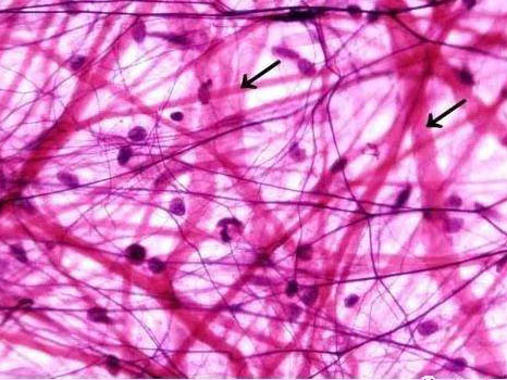 疏松结缔组织结构和作用